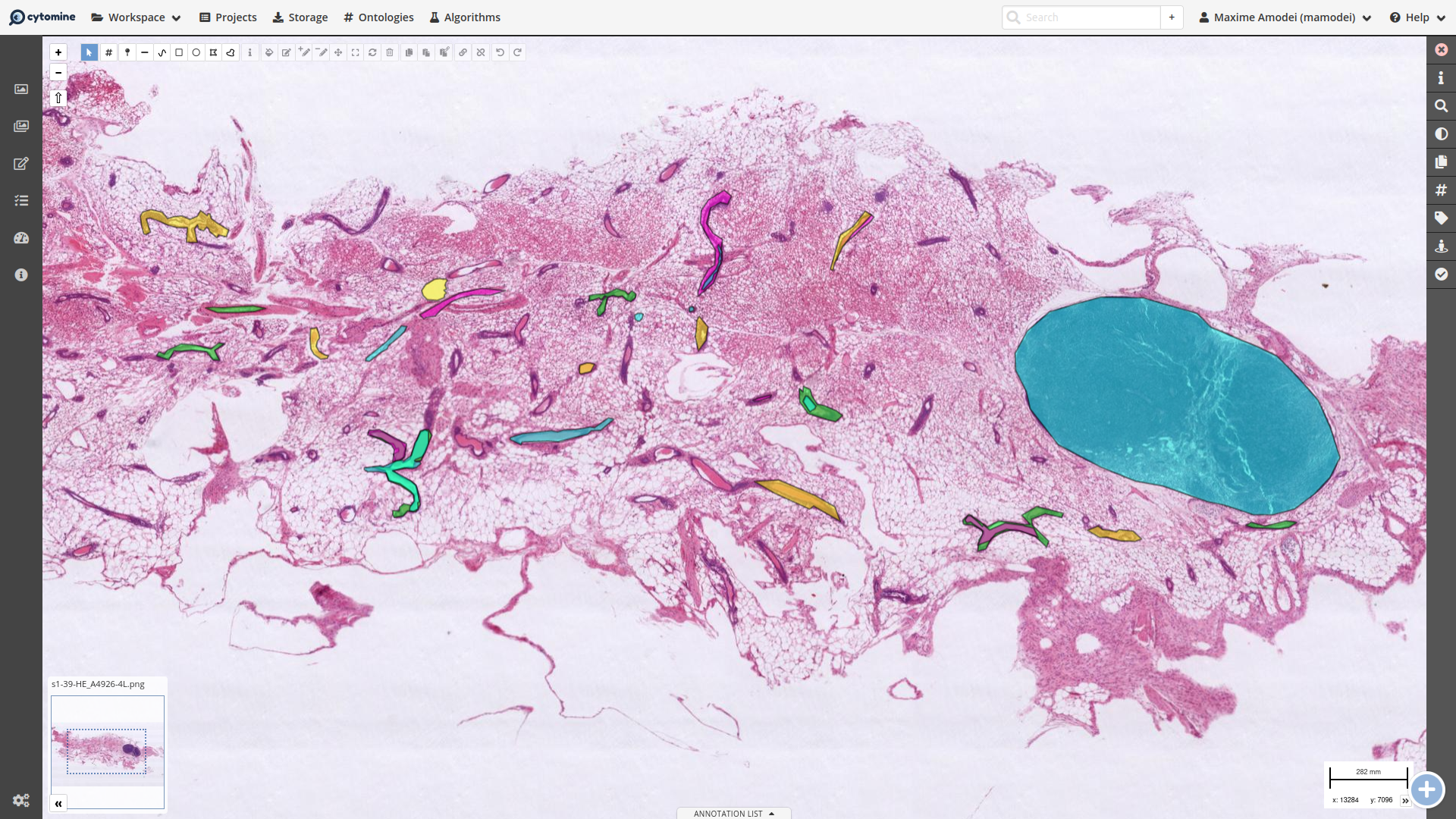 Annotations in the original reference image