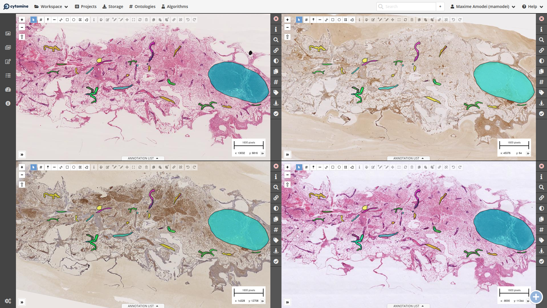 Annotations in all deformed image