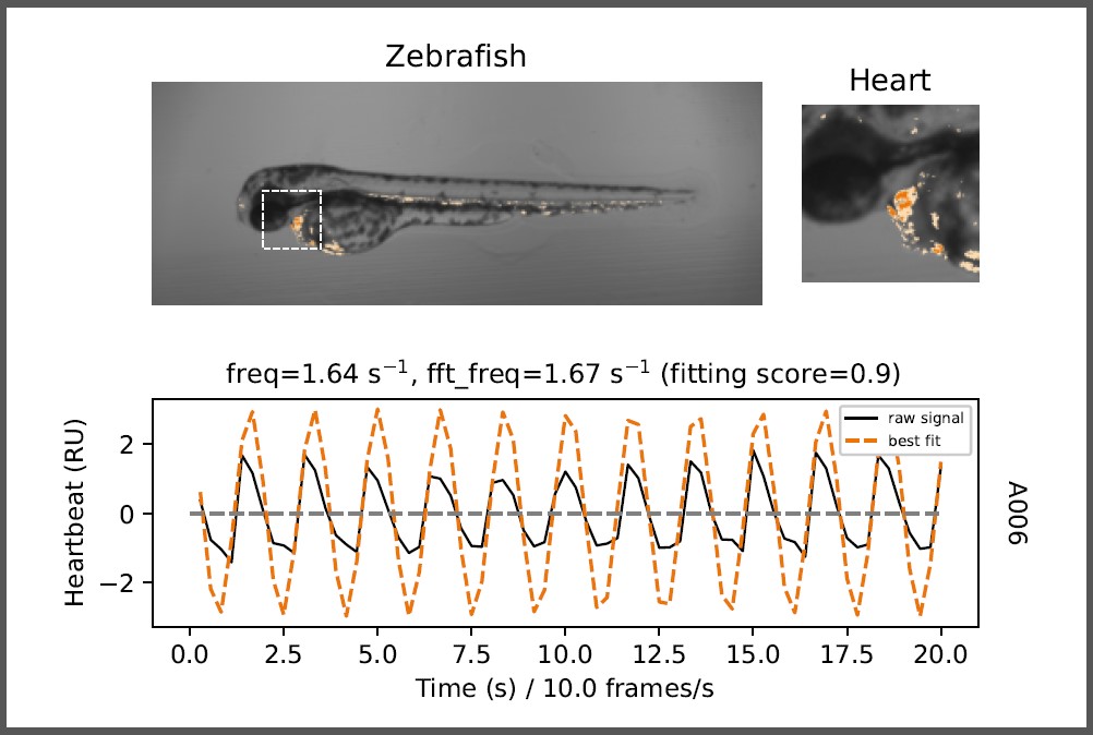 heartbeat_curve_BF