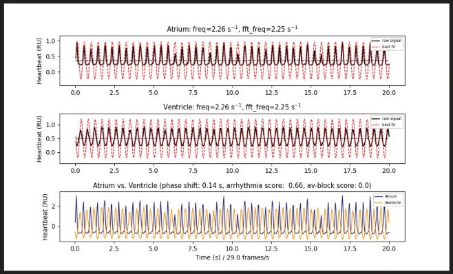 heartbeat_curve