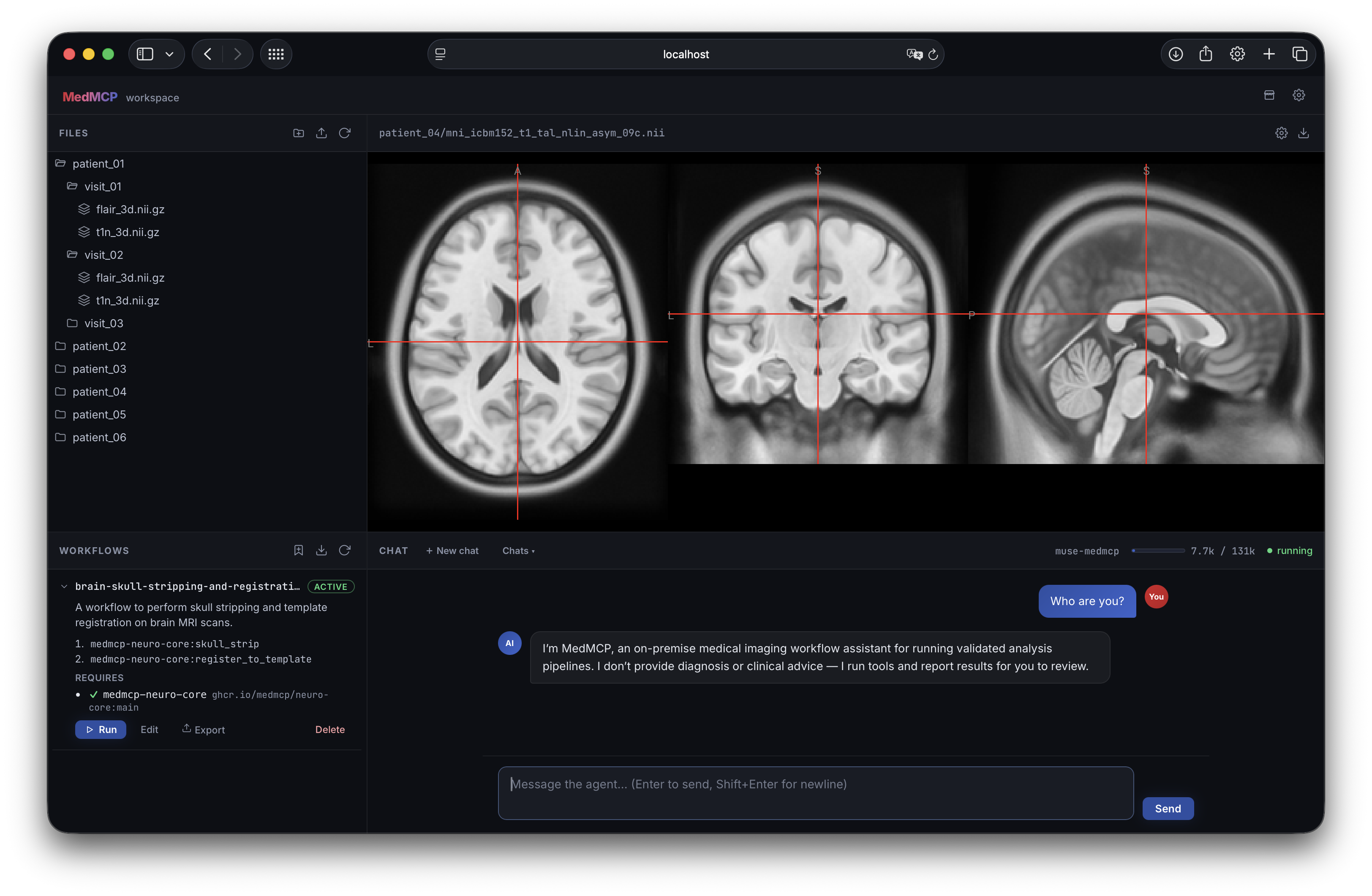 The MedMCP workspace: file explorer, medical-image viewer, workflow manager, and agent chat