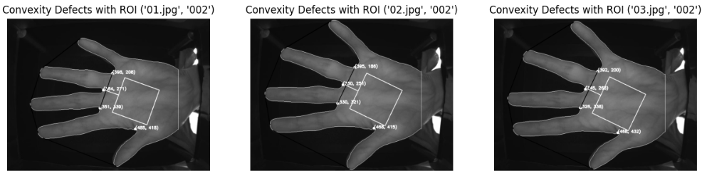 ROI on palm