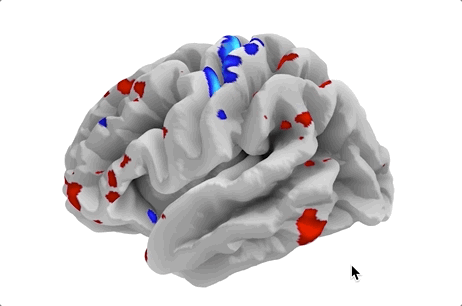 python - how to plot multiple slices of a 3d brain... GitHub - mikbuch/neuro-map-3d: Using `nilearn` package to plot 3D brain ...