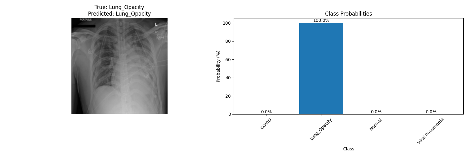 Opacity Patterns GitHub - miladnasiri/Covid-19-Radiology-Detection