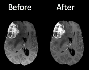 Bias correction before and after