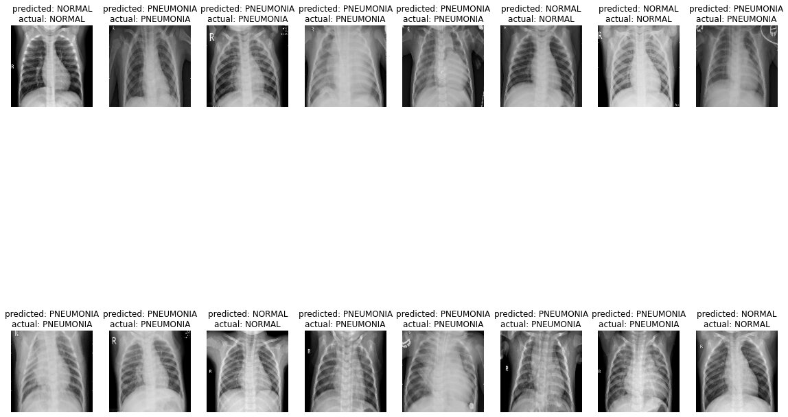 Chest X Rays Pneumonia Detection Using Convolutional