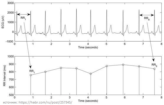 Ритмограмма наглядно