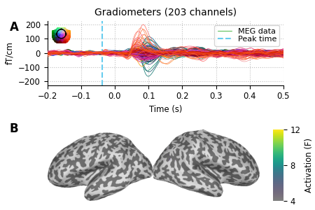 Gradiometers (203 channels)