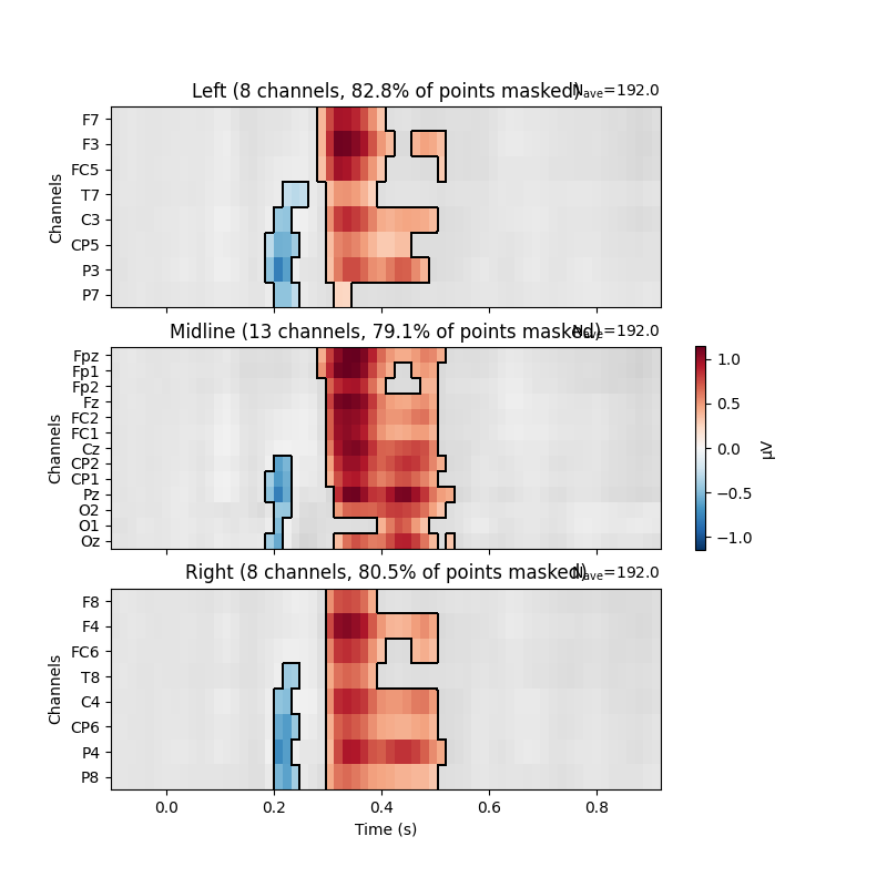 Left (8 channels, 82.8% of points masked), Midline (13 channels, 79.1% of points masked), Right (8 channels, 80.5% of points masked)