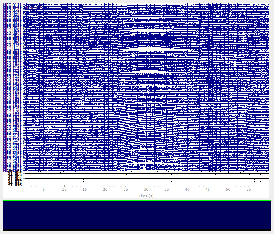 Filtering and resampling data — MNE 1.11.0.dev60+g523f221bb documentation