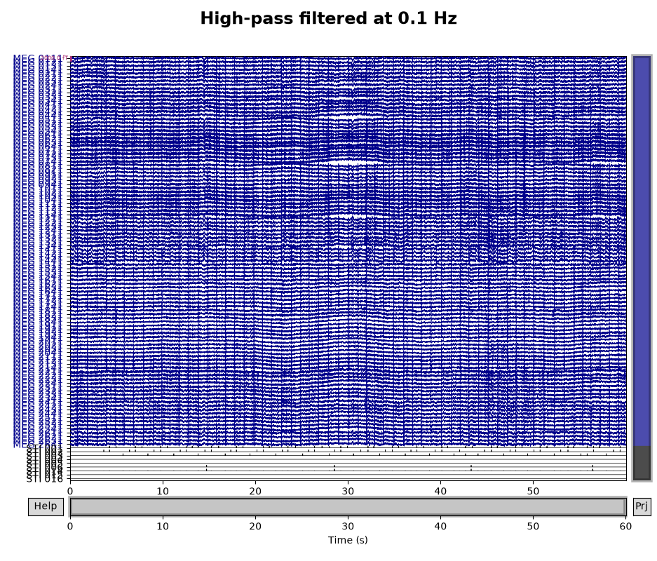 Filtering and resampling data — MNE 1.11.0.dev60+g523f221bb documentation