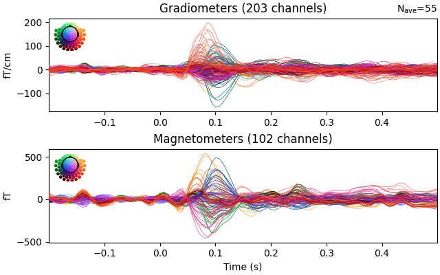 Gradiometers (203 channels), Magnetometers (102 channels)