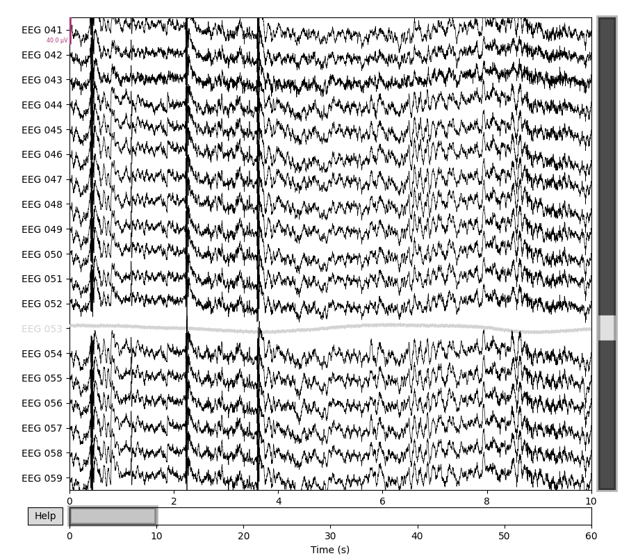 55 setting eeg reference