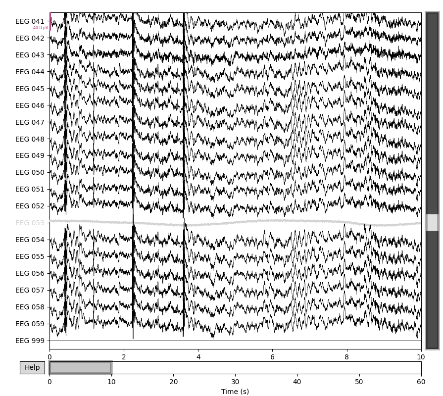 55 setting eeg reference