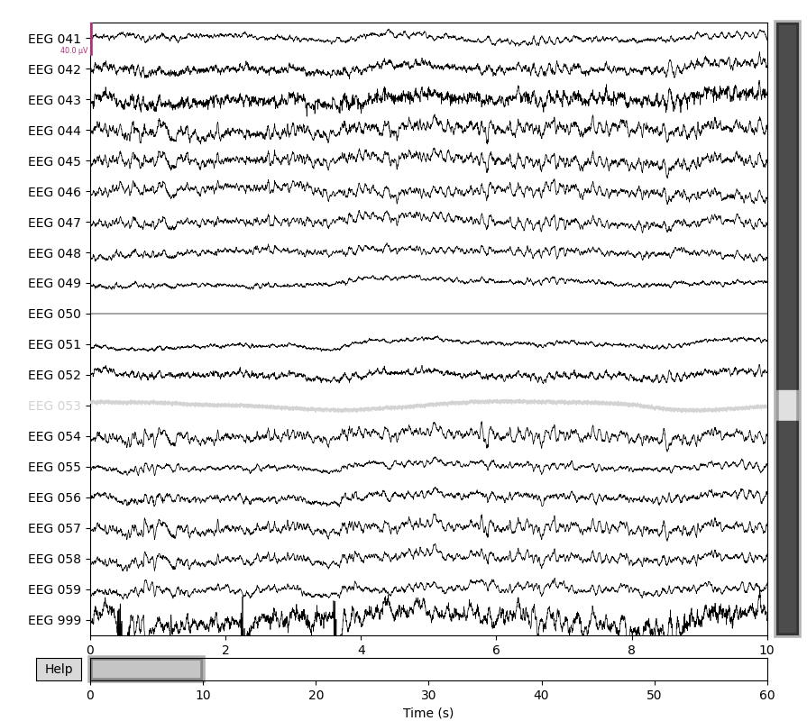 55 setting eeg reference