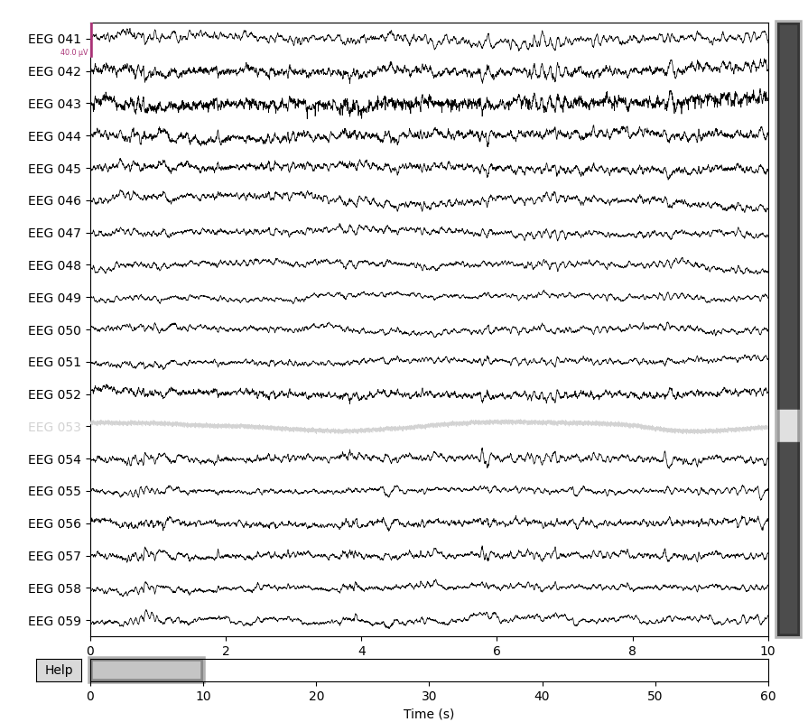 55 setting eeg reference