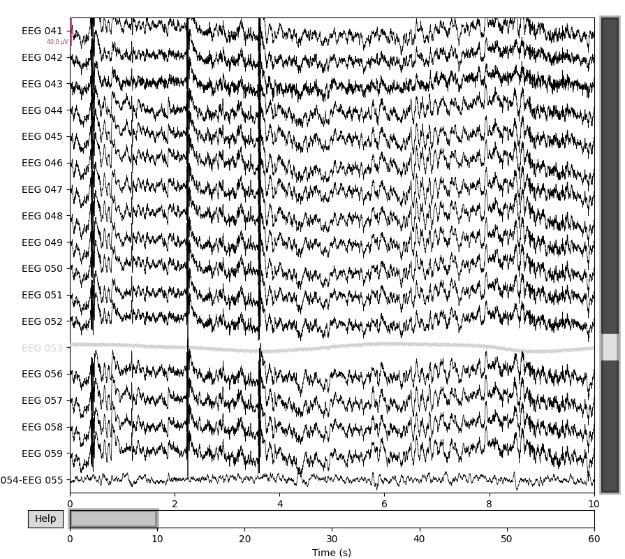 55 setting eeg reference