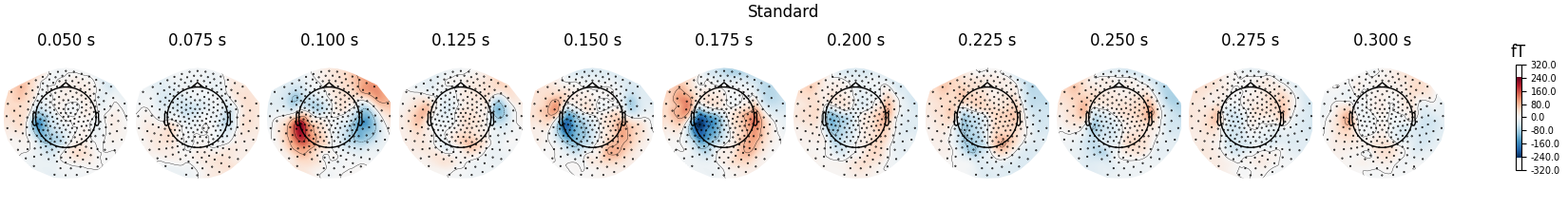 Standard, 0.050 s, 0.075 s, 0.100 s, 0.125 s, 0.150 s, 0.175 s, 0.200 s, 0.225 s, 0.250 s, 0.275 s, 0.300 s, fT