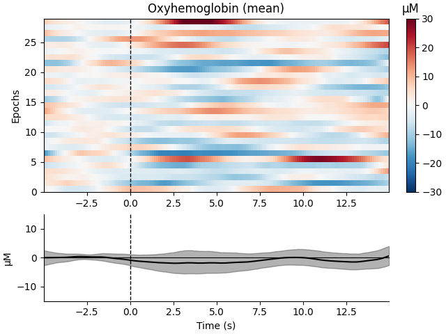 Oxyhemoglobin (mean), µM