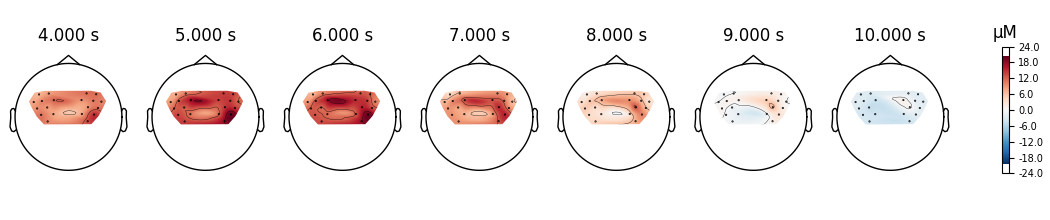 4.000 s, 5.000 s, 6.000 s, 7.000 s, 8.000 s, 9.000 s, 10.000 s, µM