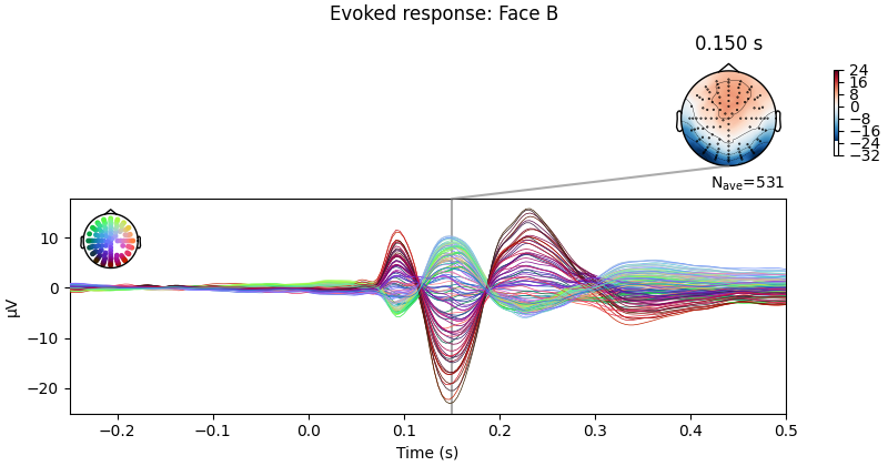 Evoked response: Face B, 0.150 s