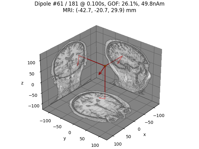 Dipole #61 / 181 @ 0.100s, GOF: 26.1%, 49.8nAm MRI: (-42.7, -20.7, 29.9) mm