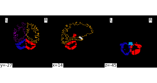 mixed source space inverse