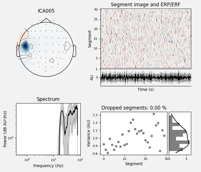 ICA005, Segment image and ERP/ERF, Spectrum, Dropped segments: 0.00 %