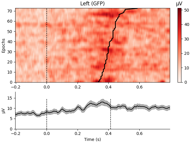 Left (GFP), µV