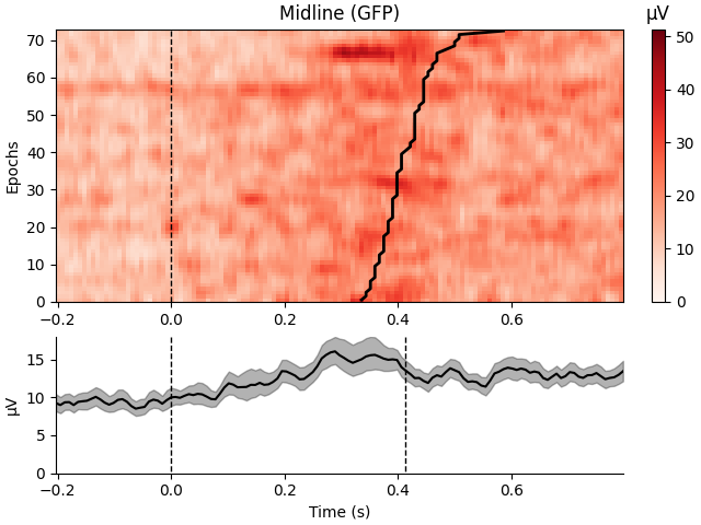 Midline (GFP), µV