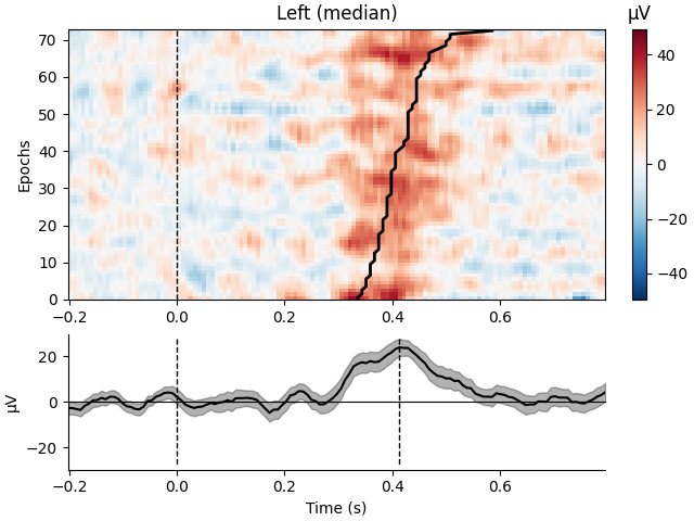 Left (median), µV