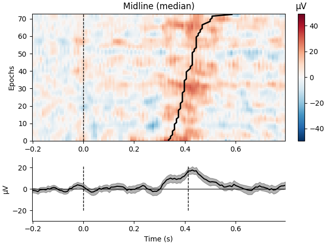 Midline (median), µV