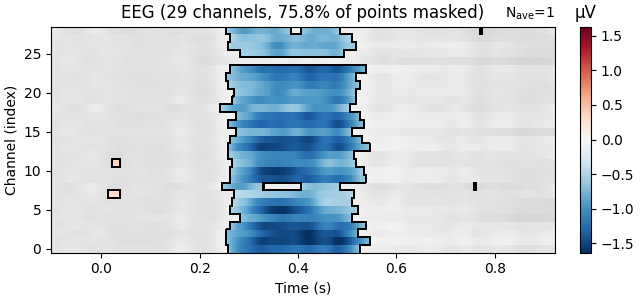 EEG (29 channels, 75.8% of points masked), µV