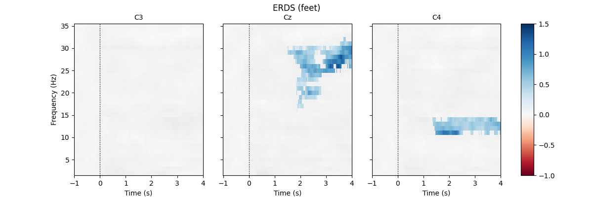 ERDS (feet), C3, Cz, C4