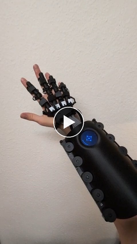 TAKTO ONE worn on the arm, phone footage, the hand opening and closing