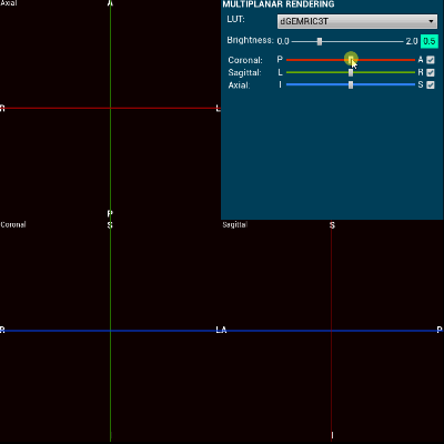 Screencast of User Widget Blueprint WBP_MPR