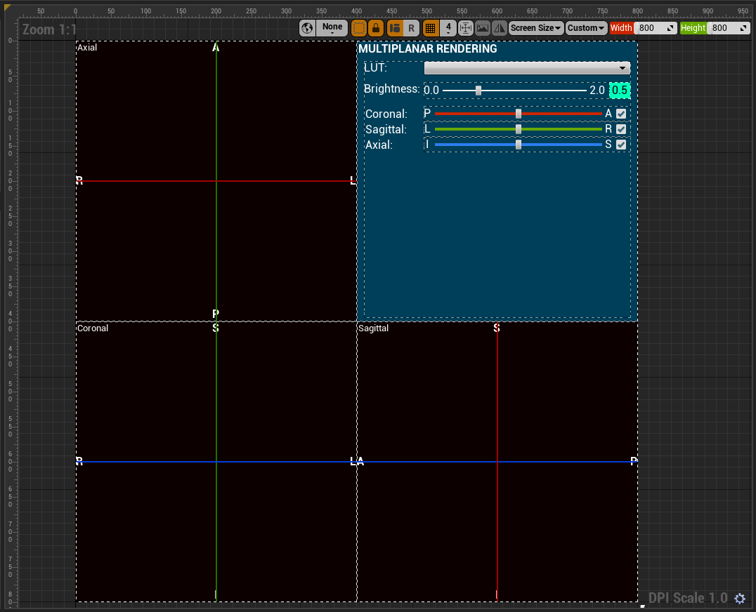 User Widget Blueprint WBP_MPR