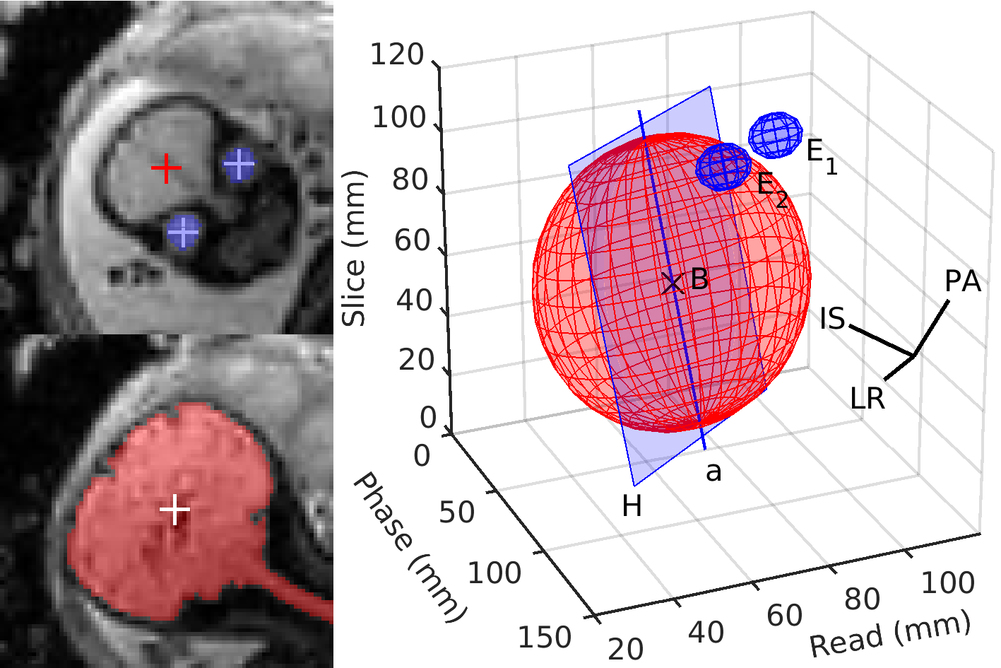 Fetal-brain geometry reconstruction