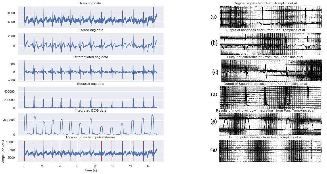 R peaks detection process