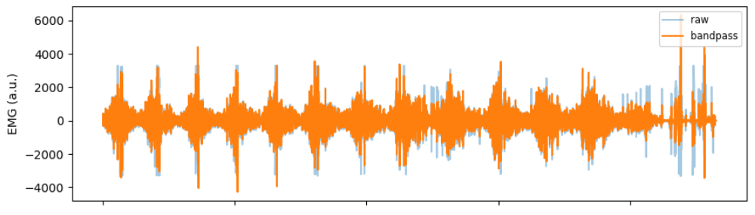 Raw Emg Example GitHub - muqsitamir/EMG_fatigue_detection: A surface electromyography ...