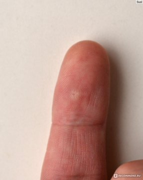 Reference image