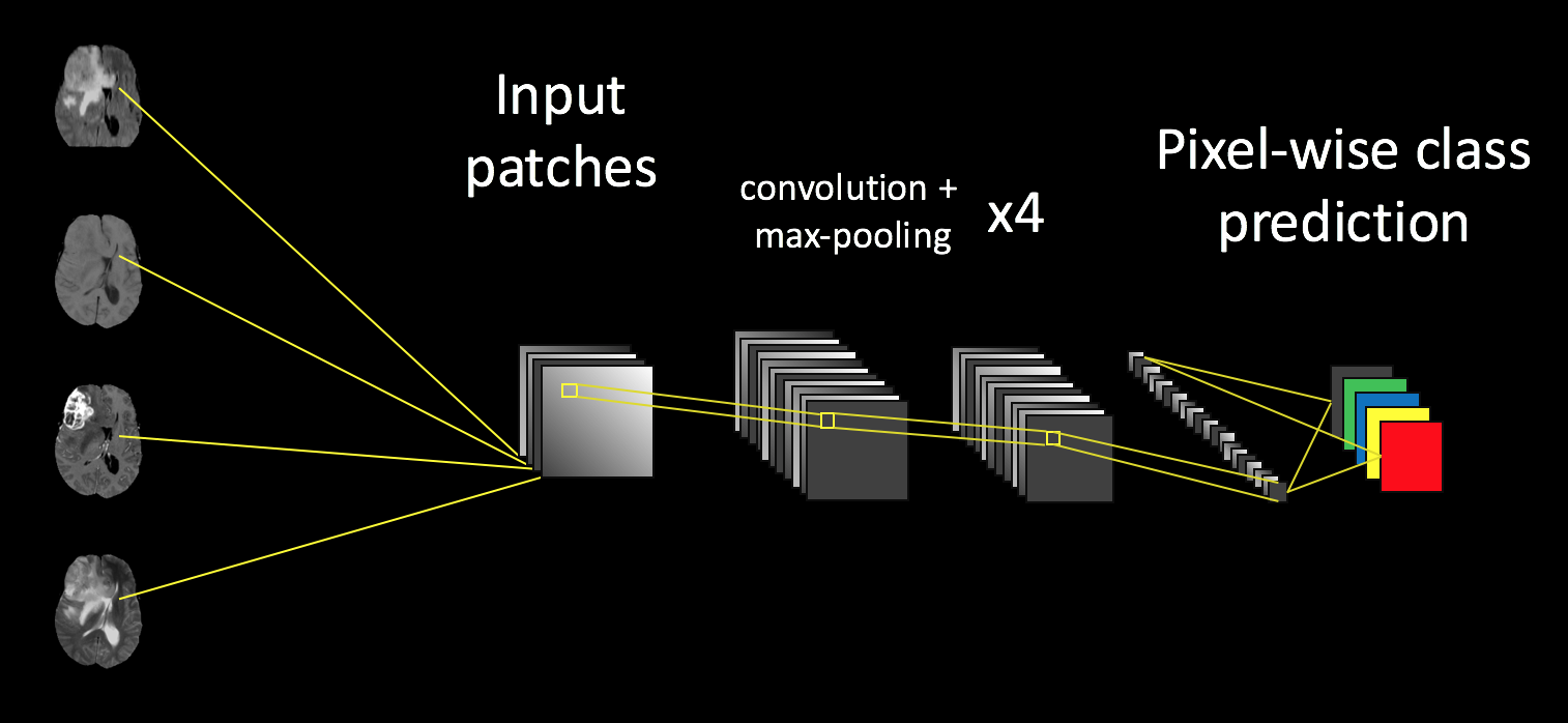 Basic ConvNet model architecture