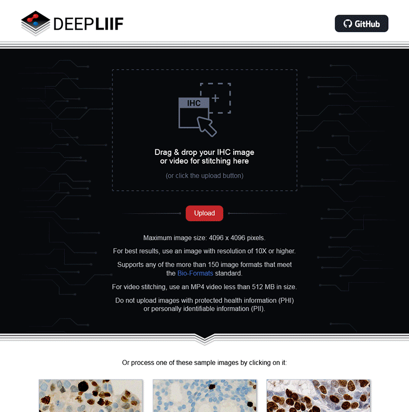 DeepLIIF Website Demo