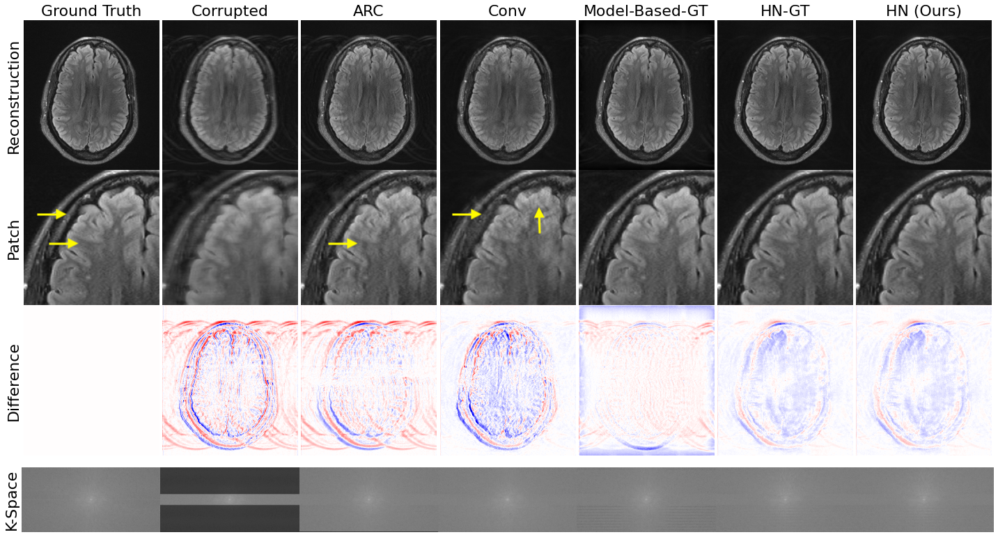 Sample reconstruction results