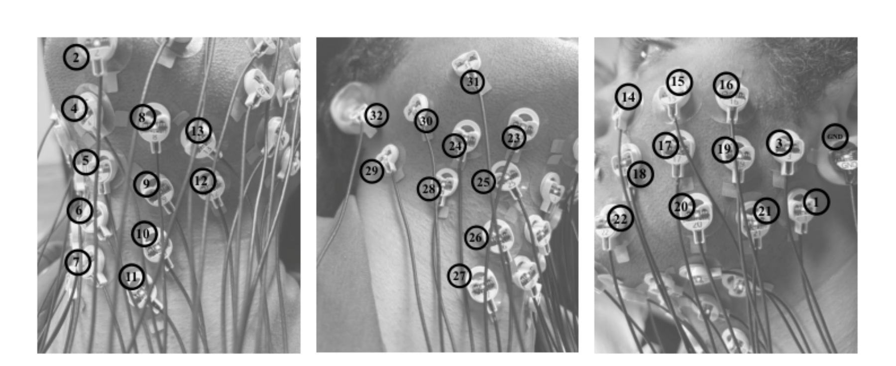 原论文 Figure 2:LEFT: Electrode placement on the left side of the neck.