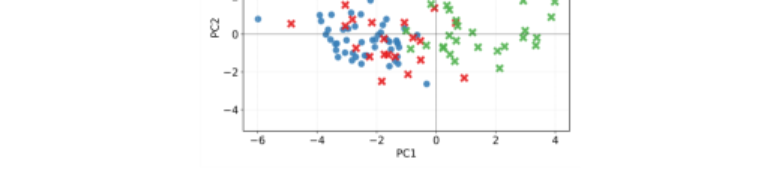 原论文 Figure 3:Comparaison entre clusters en soin et interview dans l’espace de l’ACP