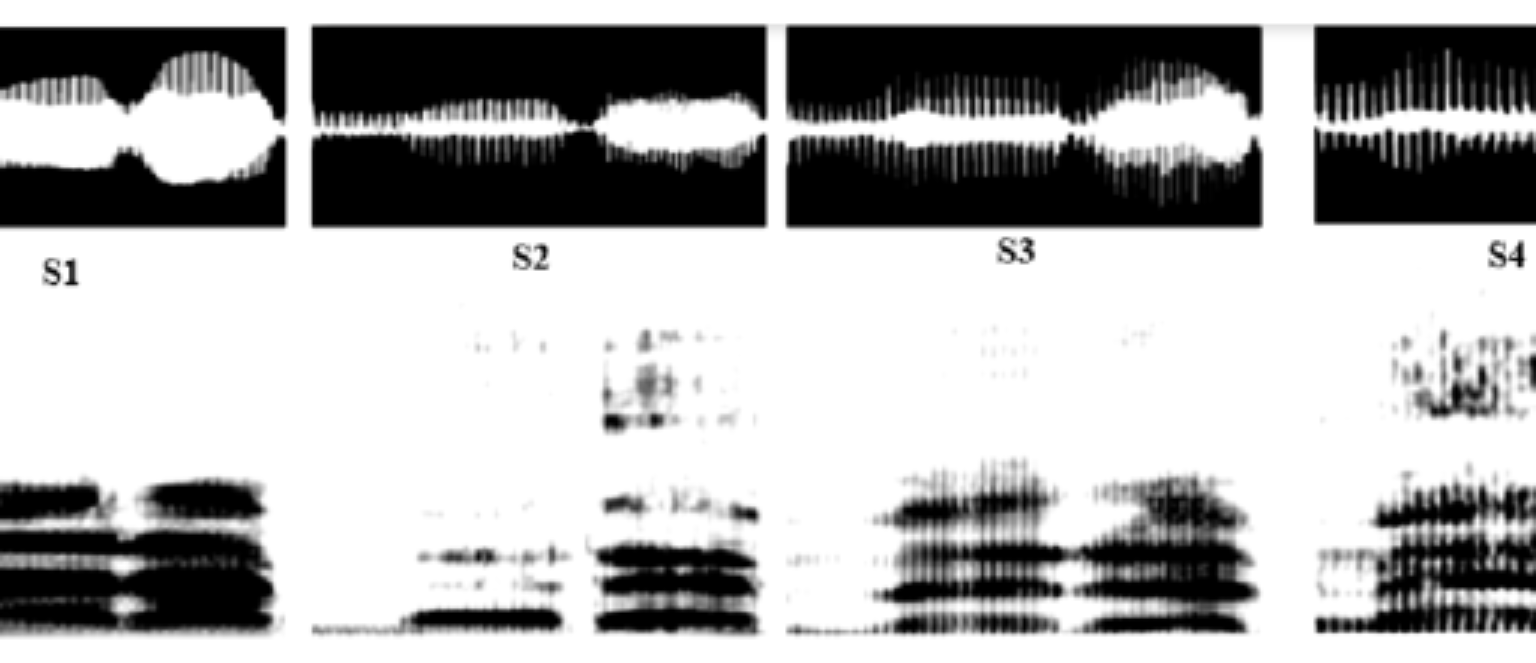 原论文 Figure 6:De gauche à droite : Forme d’onde et spectrogramme de /ma1ra2_/ de S1, S2, S3, S4.