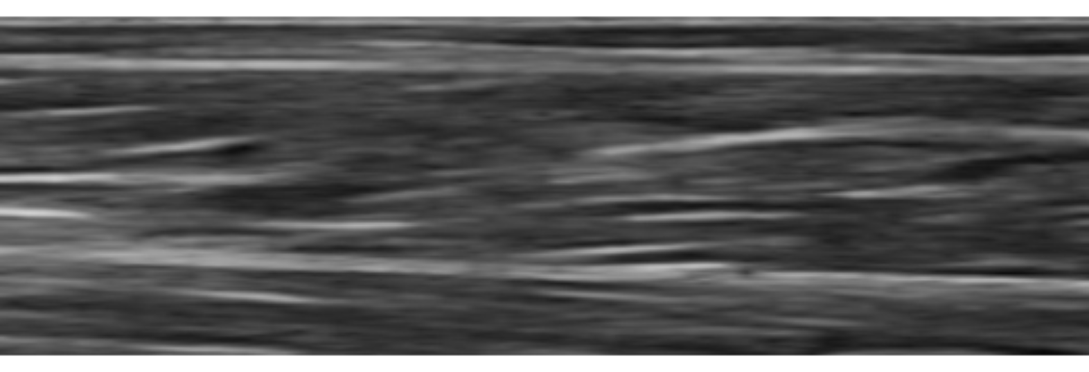 原论文 Figure 1:Linear probe image result from author’s leg muscle (depth = 0-25mm).