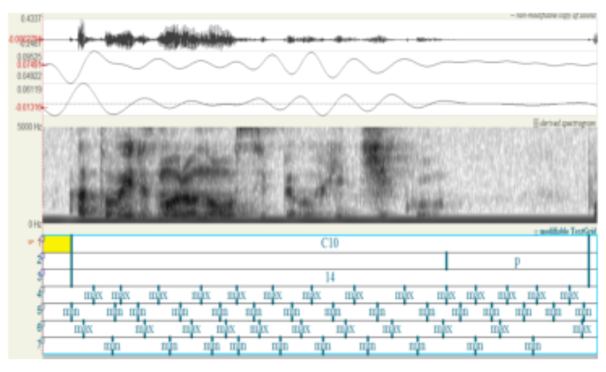 原论文 Figure 2:Waveform (top), jaw displacement (second panel, top to bottom), jaw velocity (third, top to…