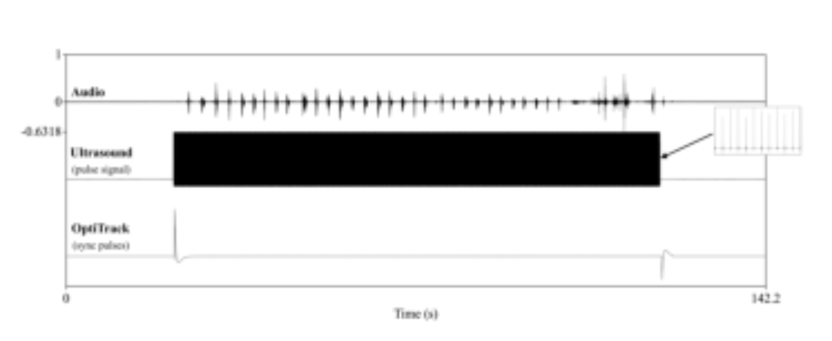 原论文 Figure 3:Example synchronized signals: audio waveform (top), ultrasound pulse signal (middle), and…